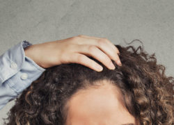 Alopecia Risk Factors You Need to Know
