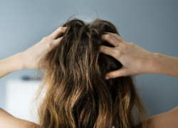 Effective Ways to Soothe Your Dry Scalp