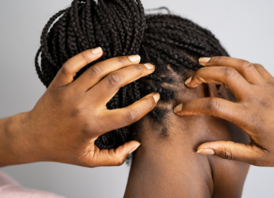 Woman itching her scalp near ear