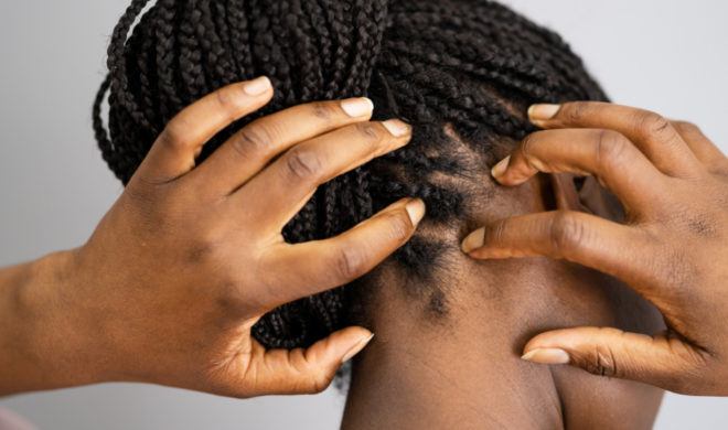 Woman itching her scalp near ear